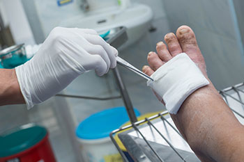 foot ulcers