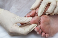 Managing Diabetic Foot Pain